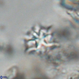 Discoaster artatus 28379