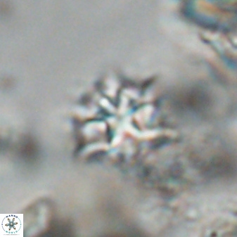 Discoaster artatus 28379