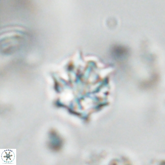 Discoaster artatus 28385