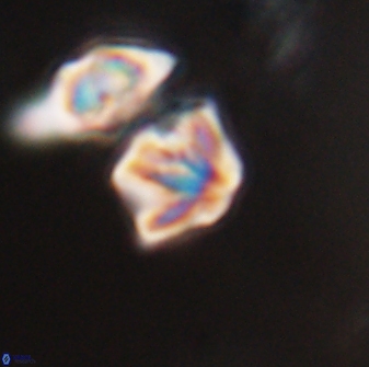 Discoaster artatus 28391