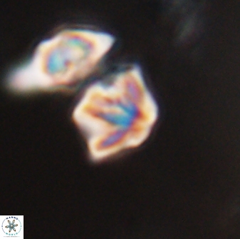 Discoaster artatus 28391