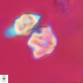 Discoaster artatus 28392