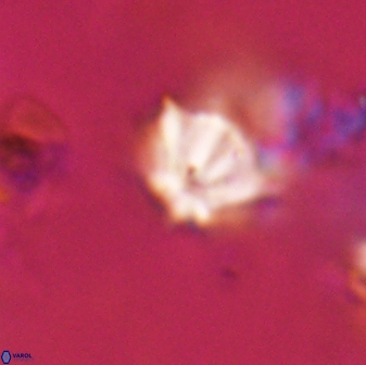 Discoaster artatus 28393