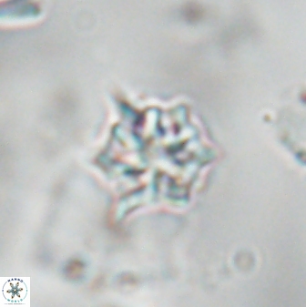 Discoaster artatus 28395