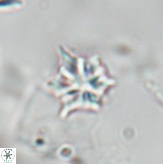 Discoaster artatus 28396