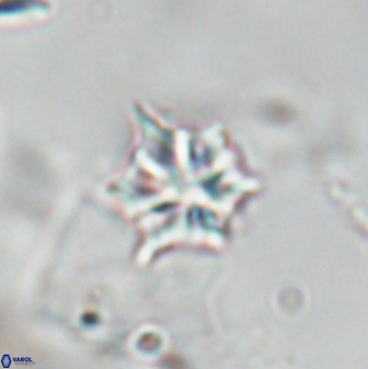 Olladiscoaster artatus 28400