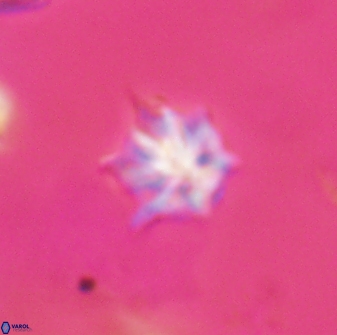 Discoaster artatus 28399