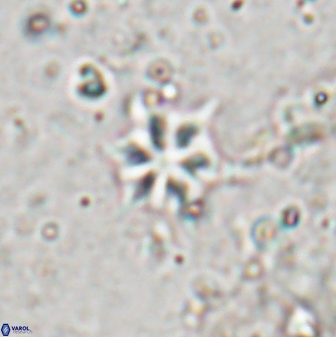 Discoaster artatus 29706