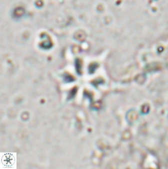 Discoaster artatus 29706