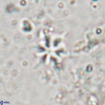 Discoaster artatus 29707