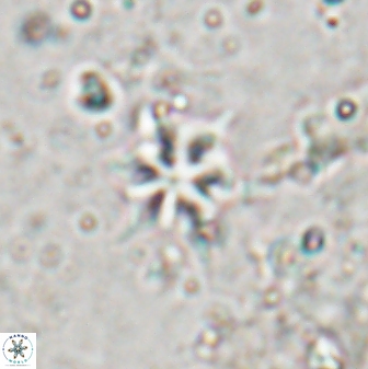 Discoaster artatus 29707
