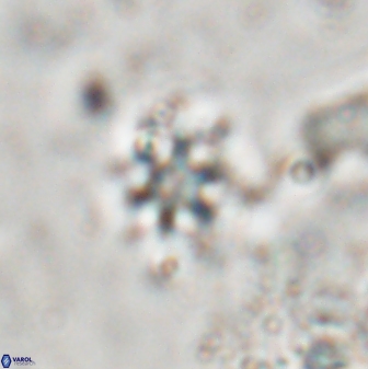 Discoaster artatus 29708