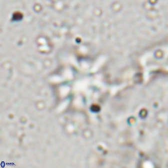 Discoaster artatus 29710