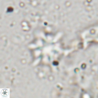 Discoaster artatus 29710