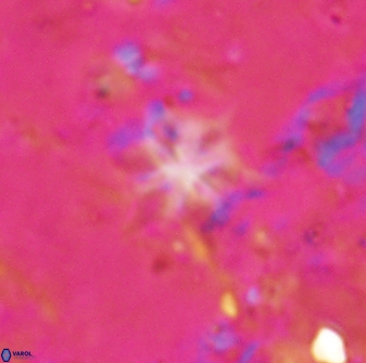 Discoaster artatus 29715