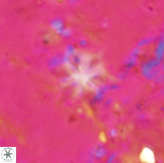 Discoaster artatus 29715
