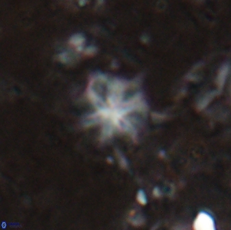 Discoaster artatus 29716