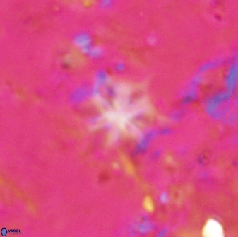 Discoaster artatus 29719