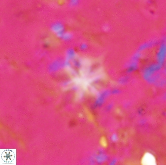 Discoaster artatus 29719