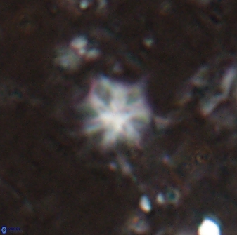 Discoaster artatus 29720