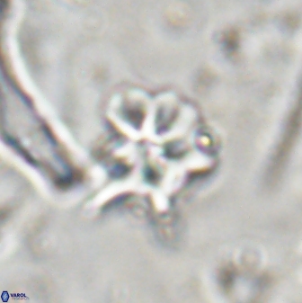 Discoaster artatus 30540