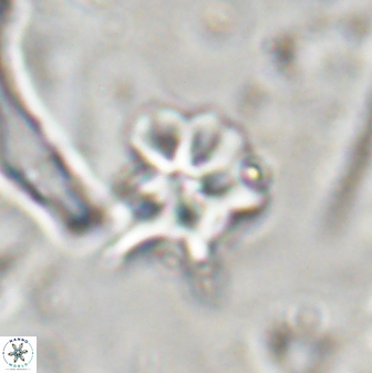 Discoaster artatus 30540