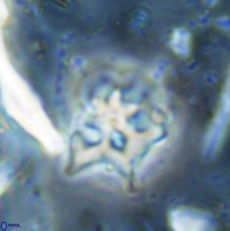 Discoaster artatus 30541