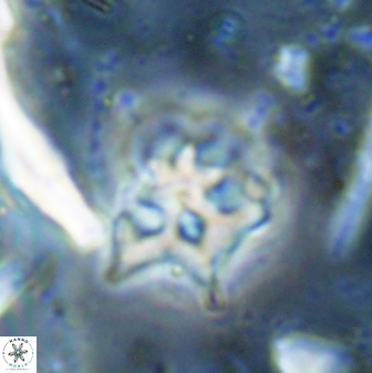 Discoaster artatus 30541