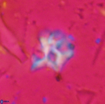 Discoaster artatus 30544