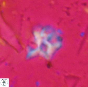 Discoaster artatus 30544
