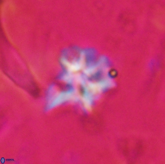 Discoaster artatus 30545