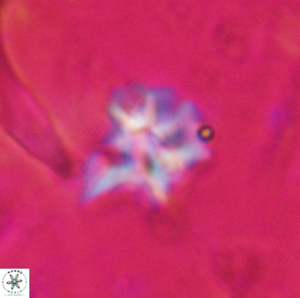Discoaster artatus 30545