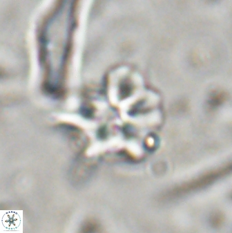 Discoaster artatus 30550