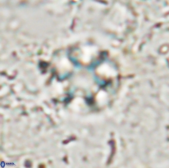 Discoaster artatus 30775