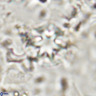 Discoaster artatus 30776