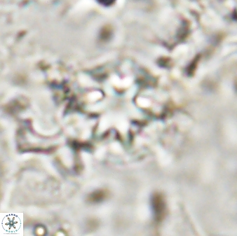 Discoaster artatus 30776