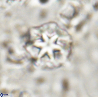 Discoaster artatus 30777