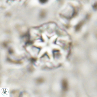 Discoaster artatus 30777