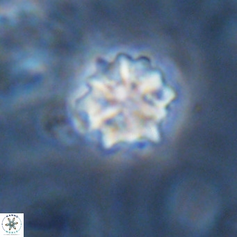 Discoaster artatus VR 18286