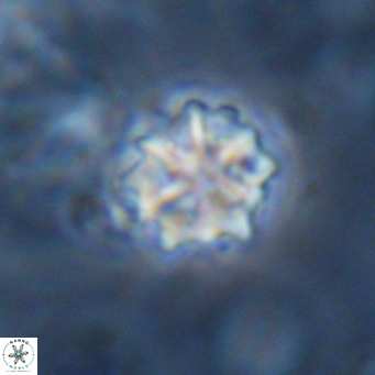 Discoaster artatus VR 18287