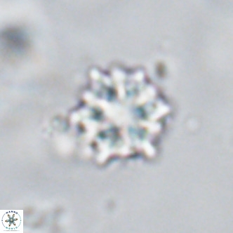 Discoaster artatus VR 18291