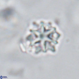 Discoaster artatus VR 18292