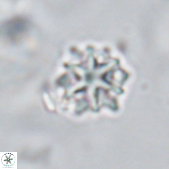 Discoaster artatus VR 18292
