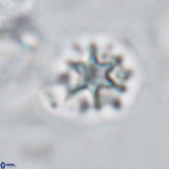 Discoaster artatus VR 18293