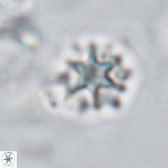 Discoaster artatus VR 18293