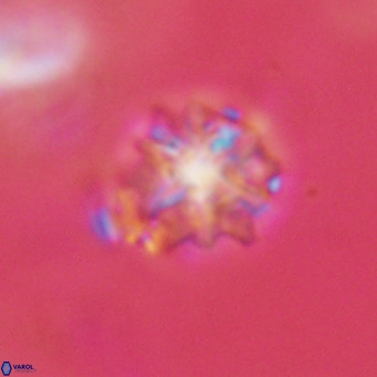 Discoaster artatus VR 18295