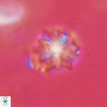 Discoaster artatus VR 18295