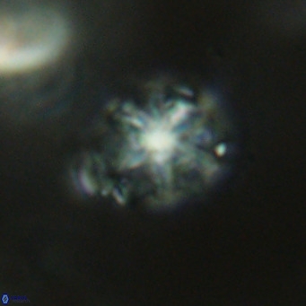 Discoaster artatus VR 18296