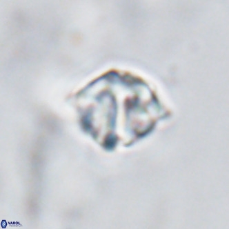 Discoaster artatus VR 18299