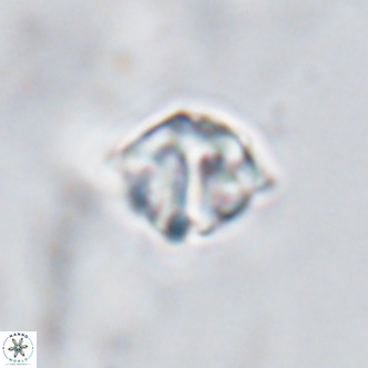 Discoaster artatus VR 18299